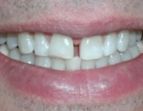 Before Transformation
