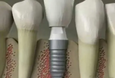 video placeholder dental work