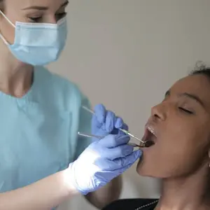 root canal