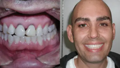 Micheal