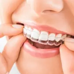 invisalign treatment