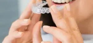 Understanding the Cost of Invisalign Treatment