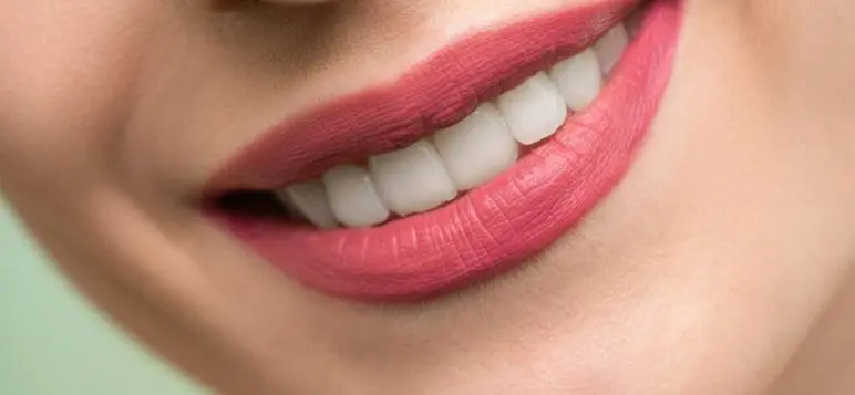 front teeth crowns image