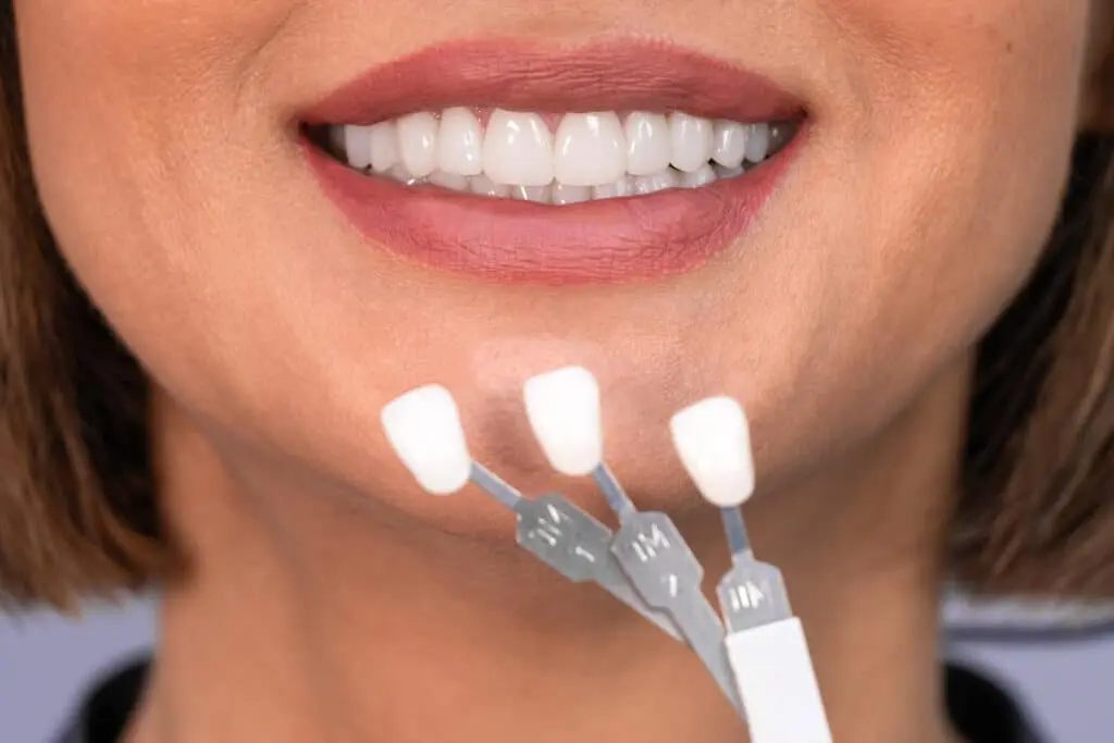 veneers image