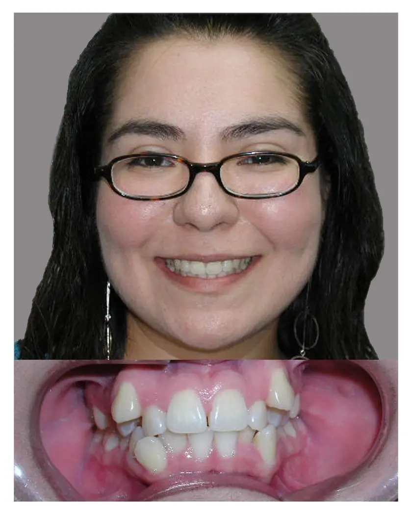 Nidia Bamp A