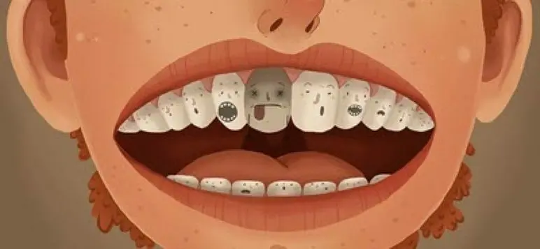 5 Signs of Tooth Decay image