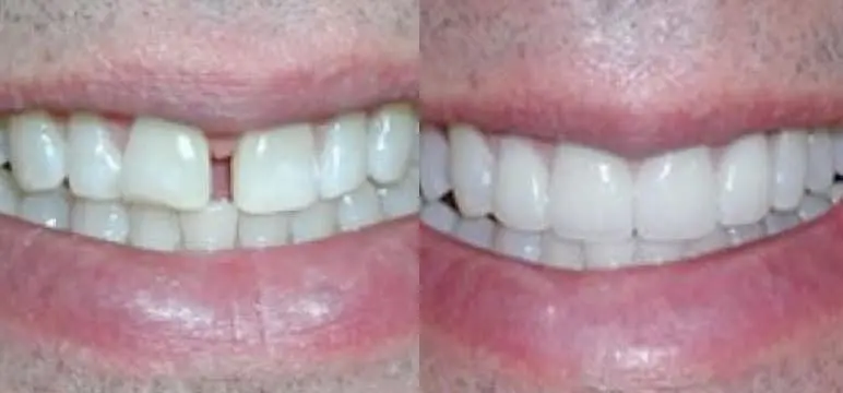 smile photo gallery link photo
