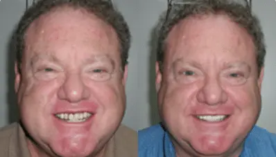 Ken