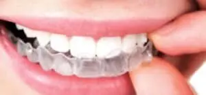 Pros & Cons of Invisalign