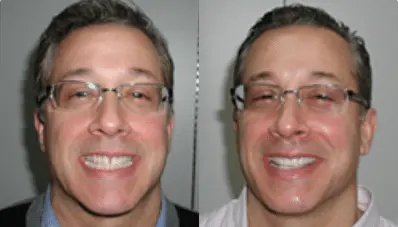 Tom