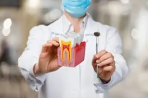 Save Your Smile: How to Avoid Root Canal Treatments