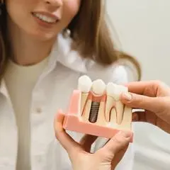dental implants