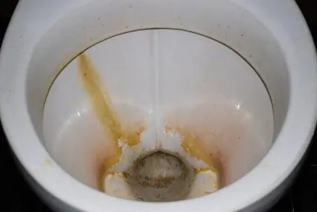 Close-up of a dirty toilet bowl interior with a prominent yellowish-brown streak and limescale buildup running down the side into the bottom.