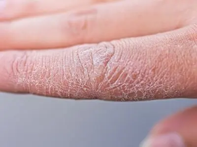 skin