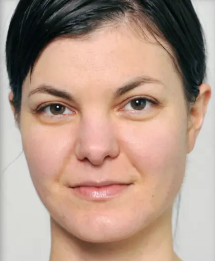 AWS BEFORE AND AFTER 2B