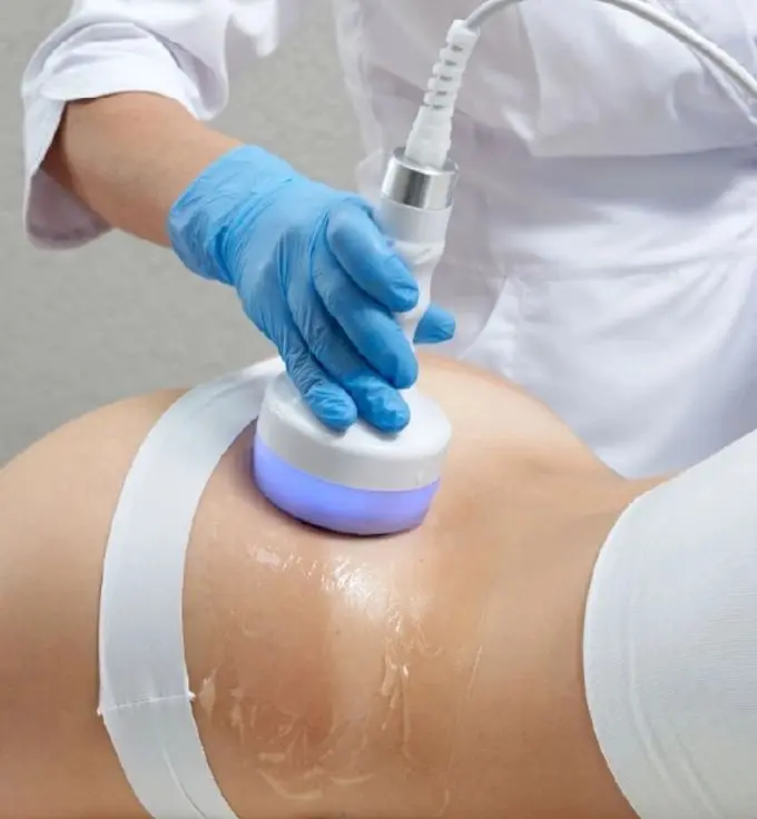 Radiofrequency body contouring: tighten, smooth, and define, no surgery and no downtime