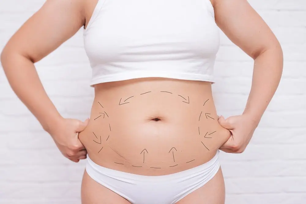 Body Contouring | Metro Dermatology