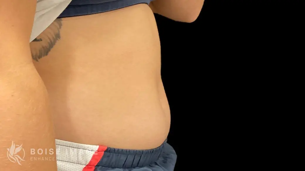 Stomach Before