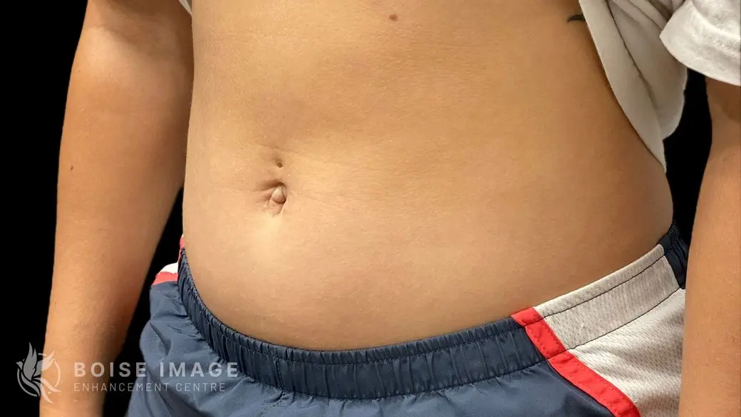 Stomach Before