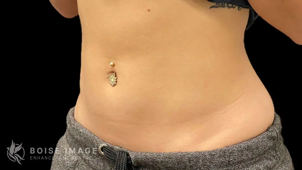 Stomach After