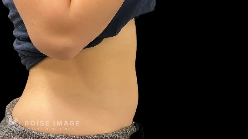 Stomach After