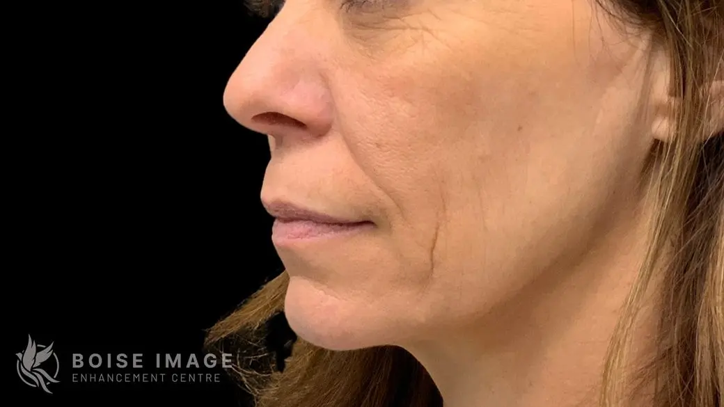 Full Face After