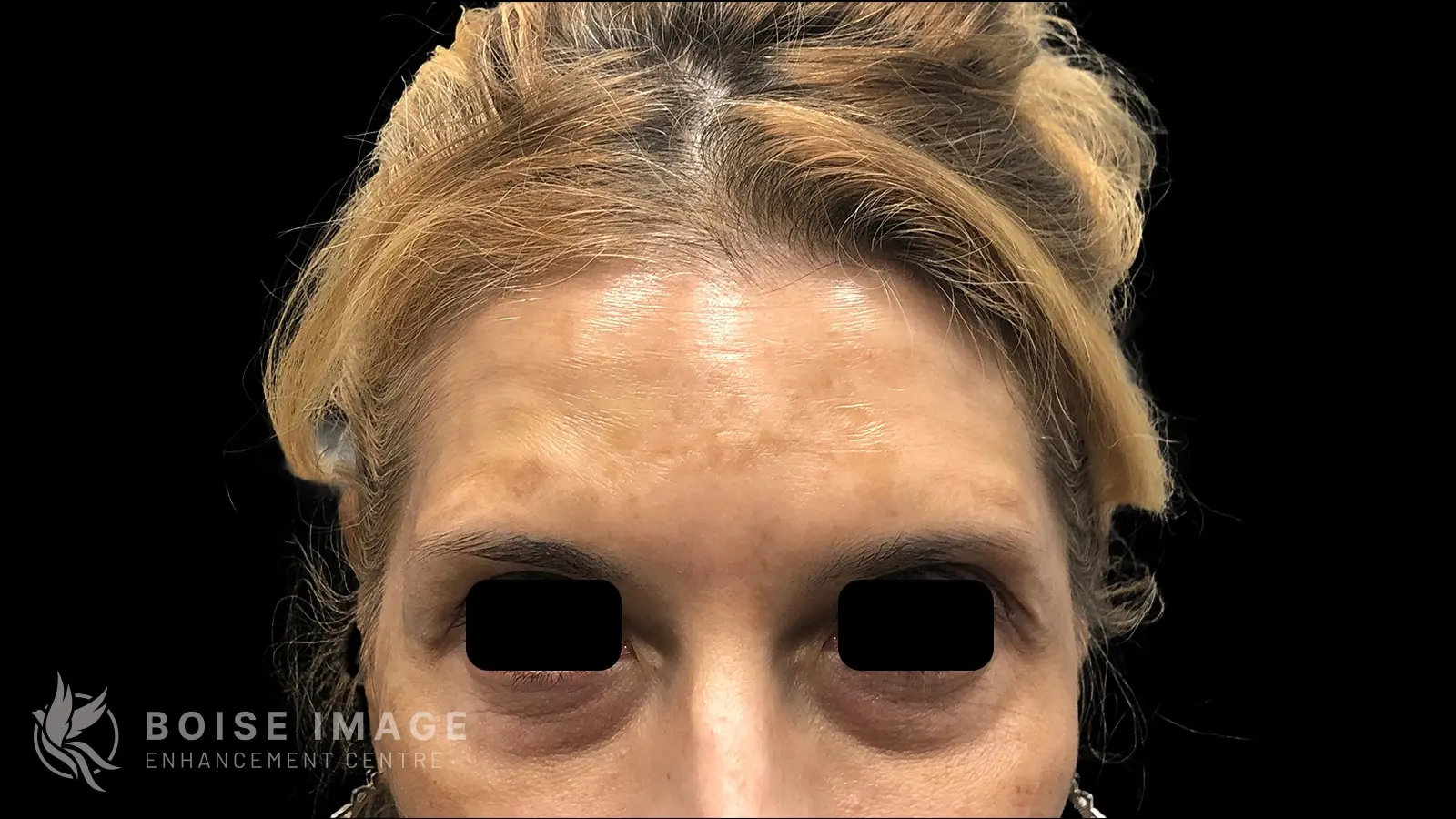 Marionette Lines After