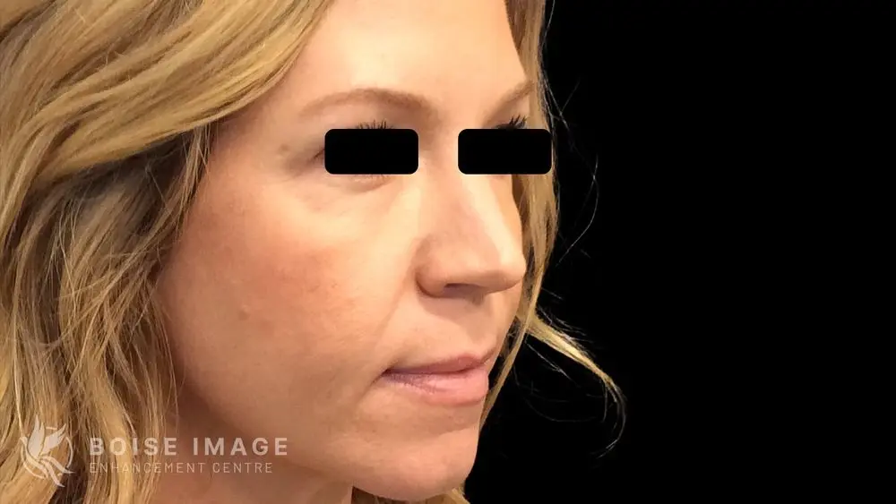 Light Lift Before