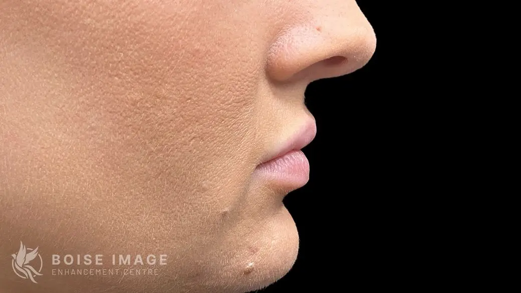 Lips Before