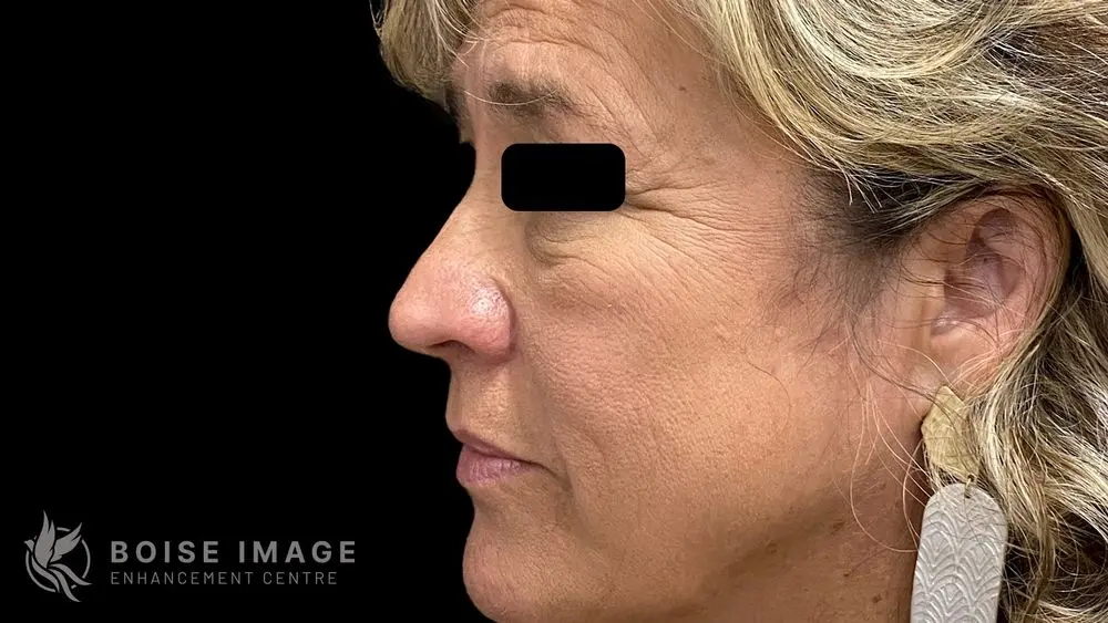 Light Lift Before