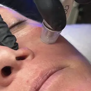 Diamond Glow Facial