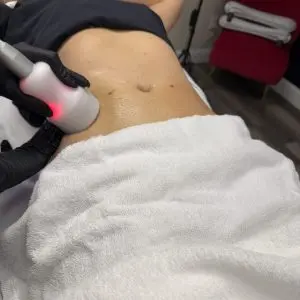 NeveSkin Skin Treatment