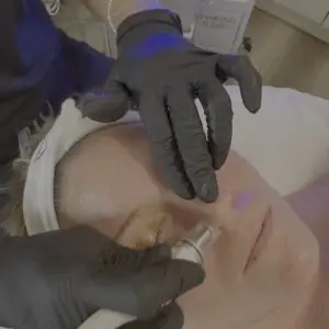 Diamond Glow Facial