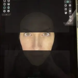 Skin Analysis