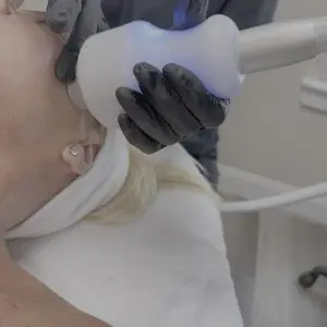 NeveSkin Skin Treatment