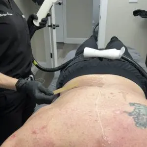 IPL Hair Removal/ Laser Hair Removal