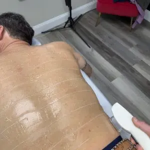 IPL Hair Removal/ Laser Hair Removal