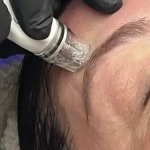 Diamond Glow Facial