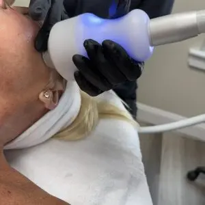 NeveSkin Skin Treatment