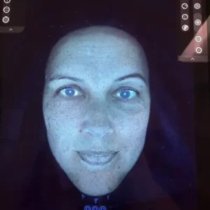 Skin Analysis