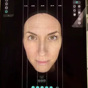Skin Analysis