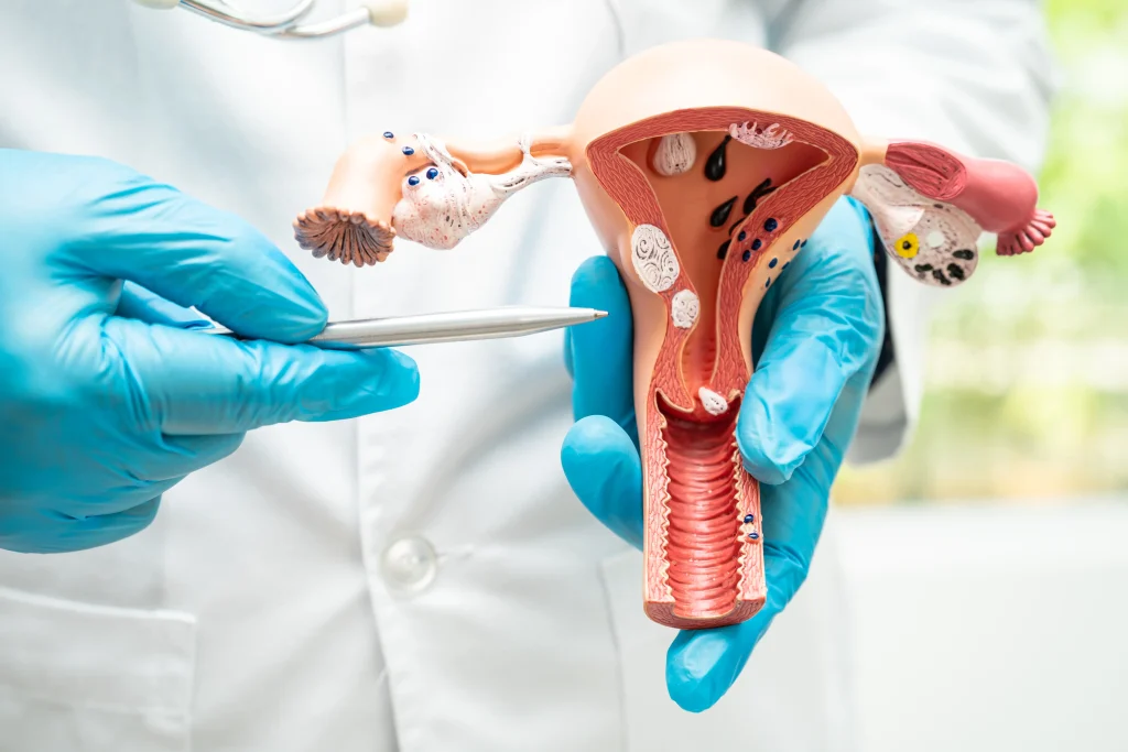 Medical 25 uterus model clinical obgyn