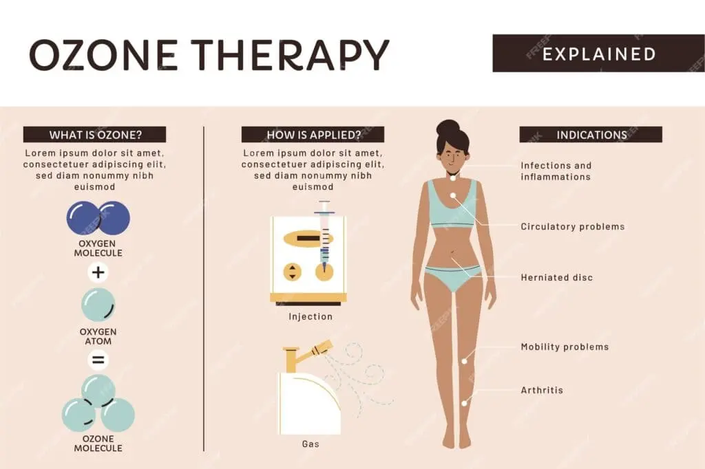 ozone therapy