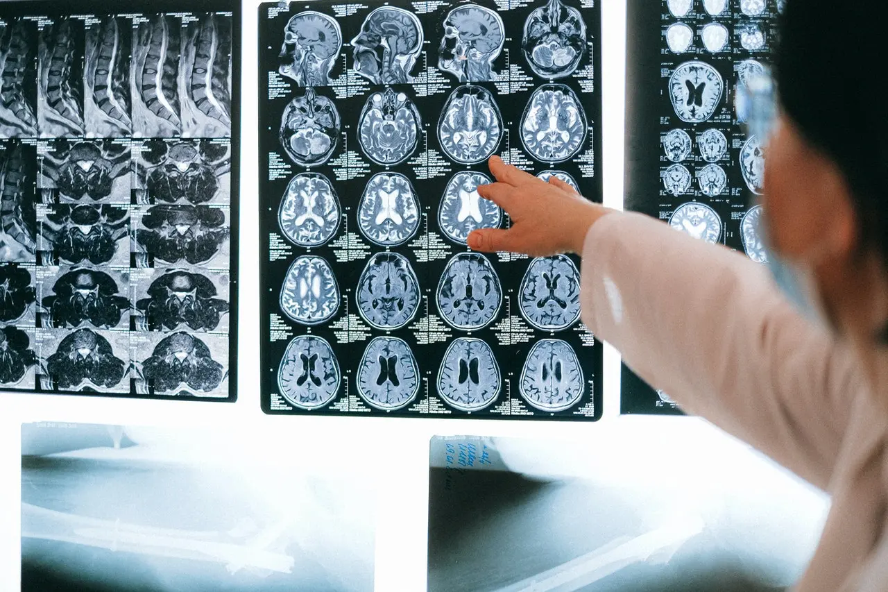 What to Expect During a Brain MRI in Brooklyn NY