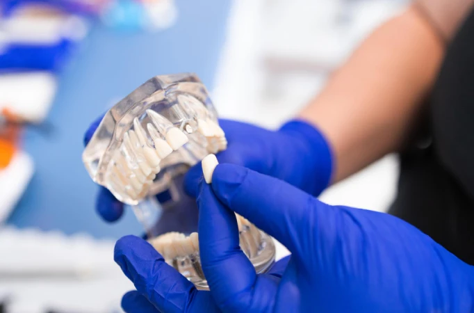 Tooth replacement options: dental implants vs dentures