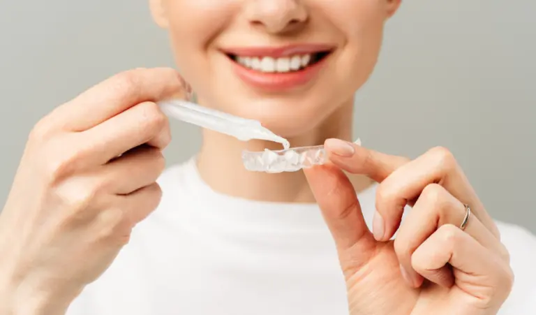 women-teeth-whitening-treatment-Woodbury-MN
