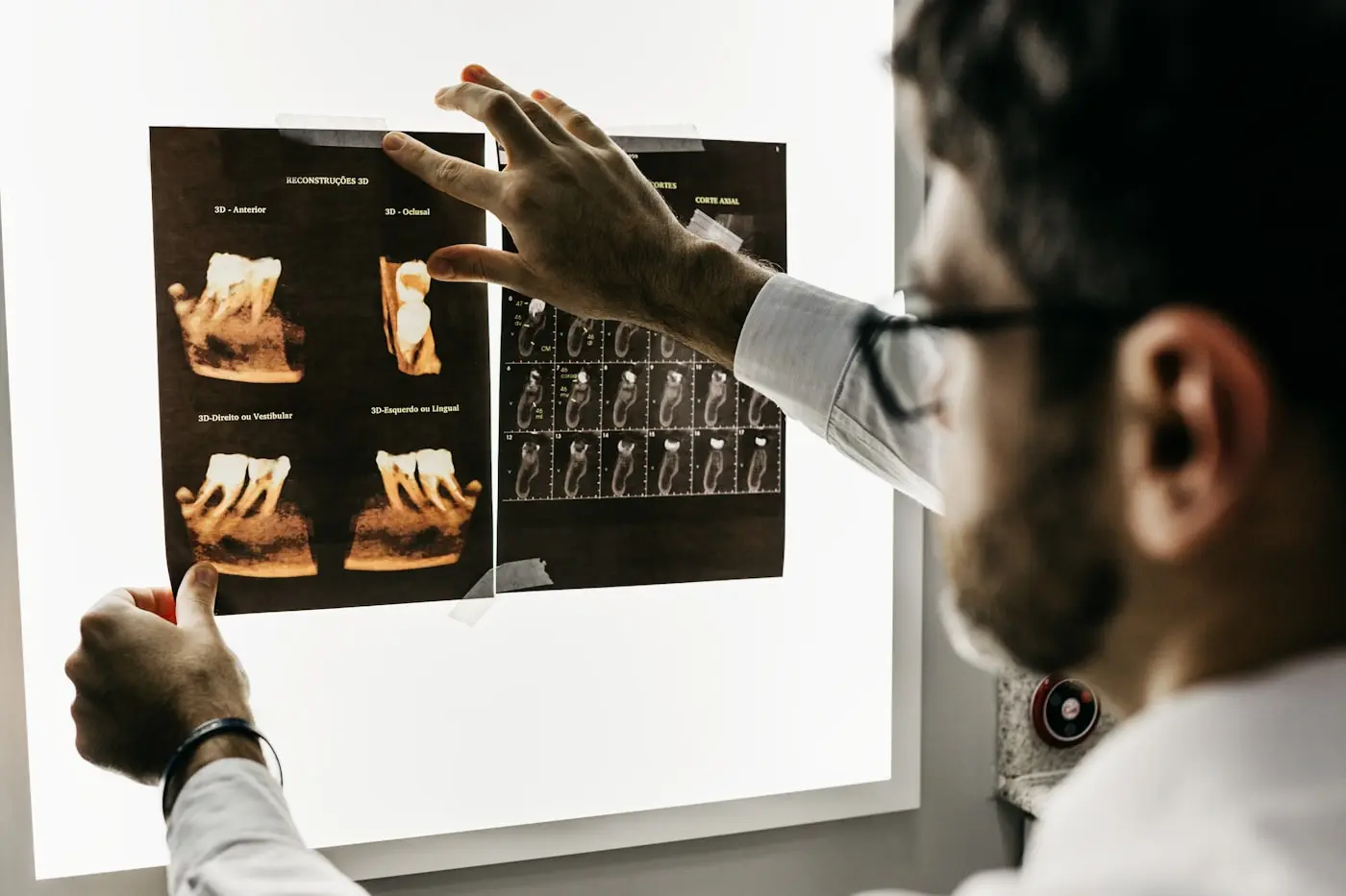tp-xray-films