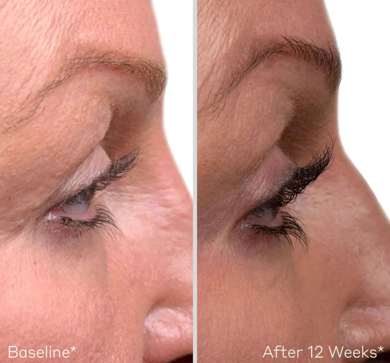 Obagi Lash Serum