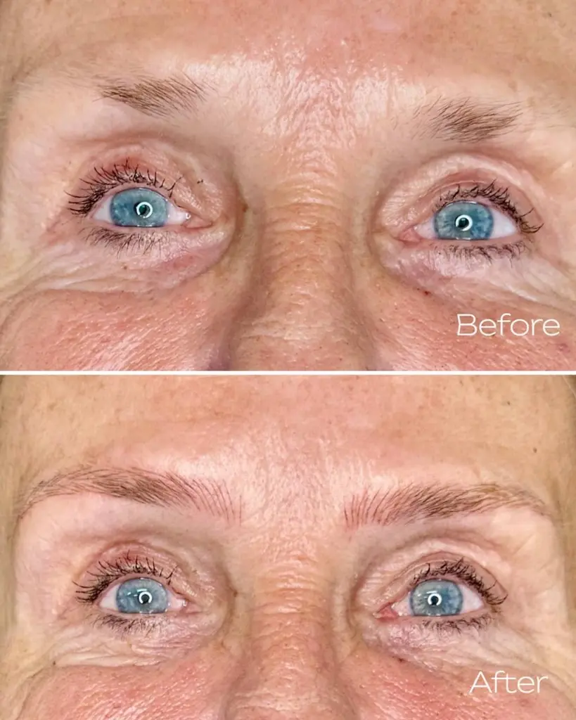 Microblading