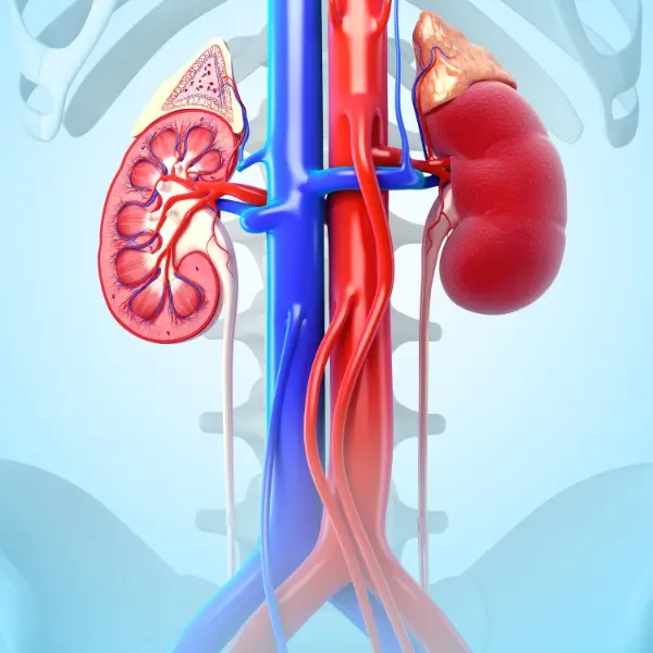 kidney-stones-2024-27